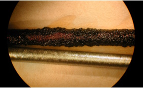 サーボバルブ用ペンシルフィルタ*8（varnishで目詰まりしたフィルタ，下は新品）